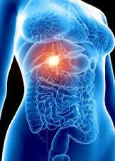 Limpieza de cálculos de la vesícula / Gallbladder stone cleansing